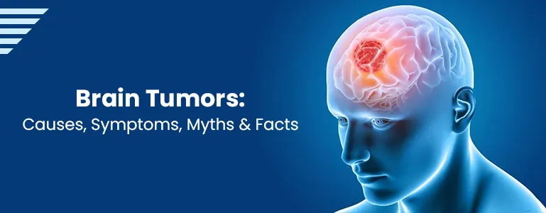 Brain Tumors: Causes, Symptoms, Myths, and Facts | Sprint diagnostics