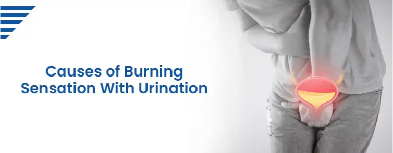 Causes of Burning Sensation With Urination