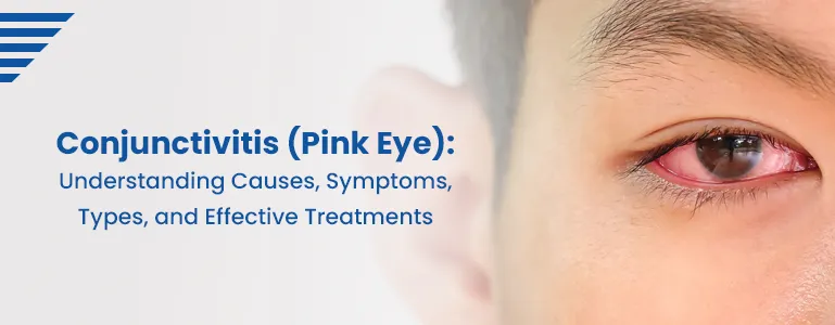conjunctivitis-pink-eye-causes-symptoms-treatments