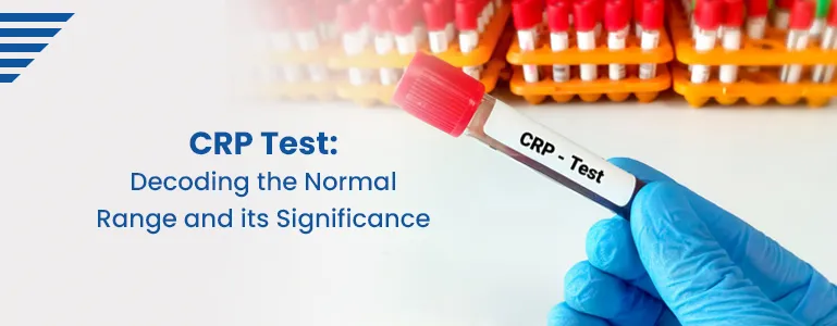crp-test-decoding-normal-range