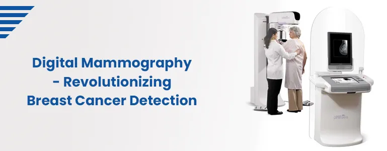 Digital Mammography: Revolutionizing Breast Cancer Detection 