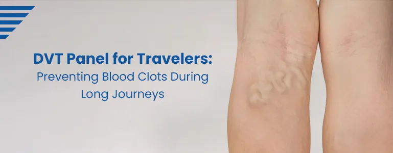 DVT Panel for Travelers: Preventing Blood Clots During Long Journeys