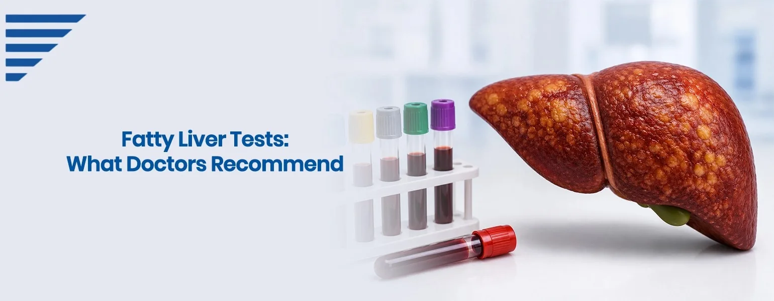 Tests doctors use to detect fatty liver