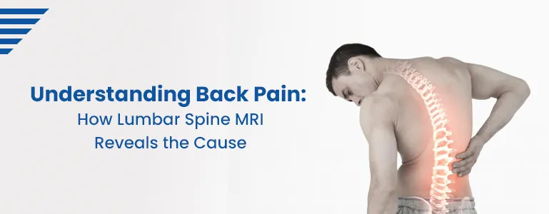how-lumbar-spine-mri-reveals-back-pain-cause