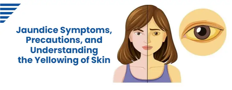Jaundice Symptoms, Precautions, and Understanding the Yellowing of Skin