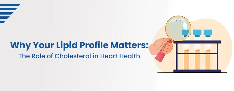 Why Your Lipid Profile Matters: The Role of Cholesterol in Heart Health