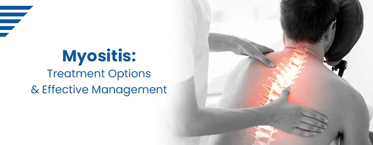 Exploring Myositis: Treatment Options and Effective Management Strategies