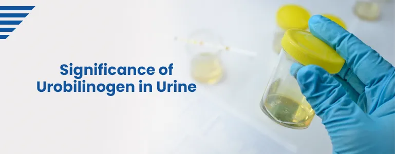 significance-of-urobilinogen-in-urine
