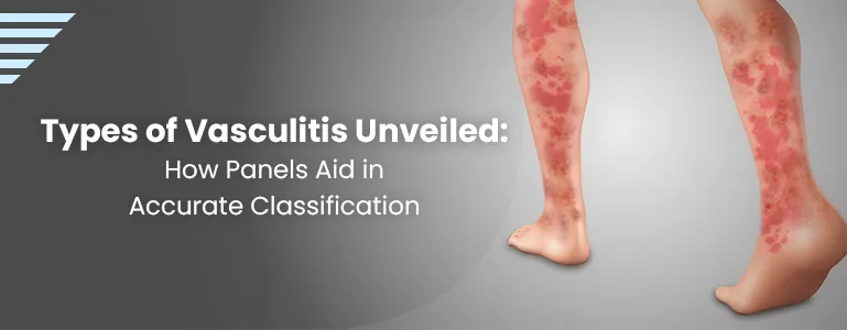 vasculitis-types-and-panel