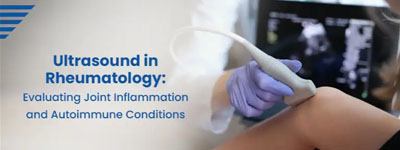 Ultrasound in Rheumatology: Evaluating Joint Inflammation and Autoimmune Conditions