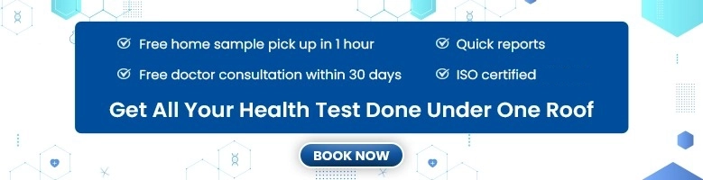 HOMA Index Insulin Resistance Test