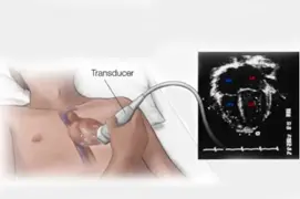 2D ECHO Test