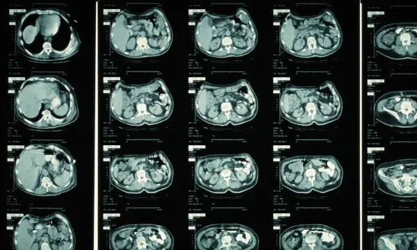 CT scan image report
