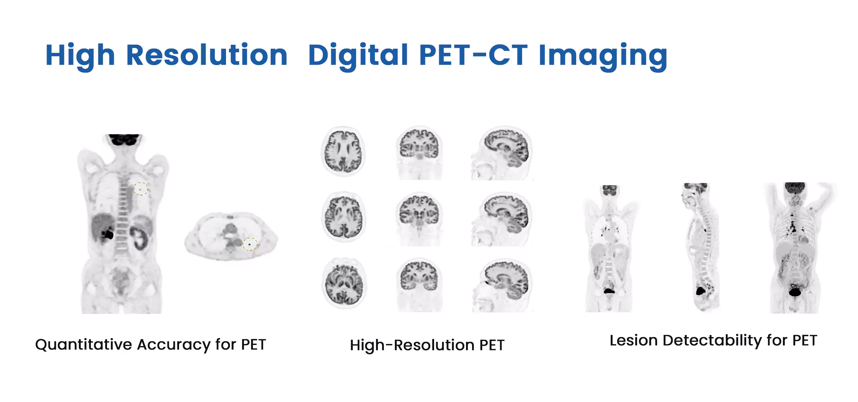 Digital PET CT Imaging