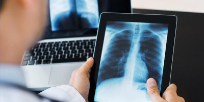 Digital X-ray