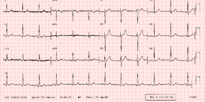 ECG (Electrocardiograph)