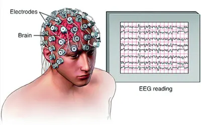 an eeg test for brain
