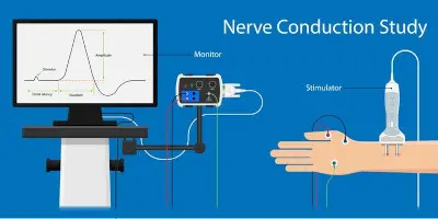 Nerve Conduction Study (NCS)