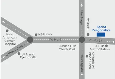 Sprint Diagnostics AS Rao Nagar address