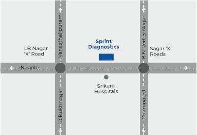 Sprint Diagnostics LB Nagar address