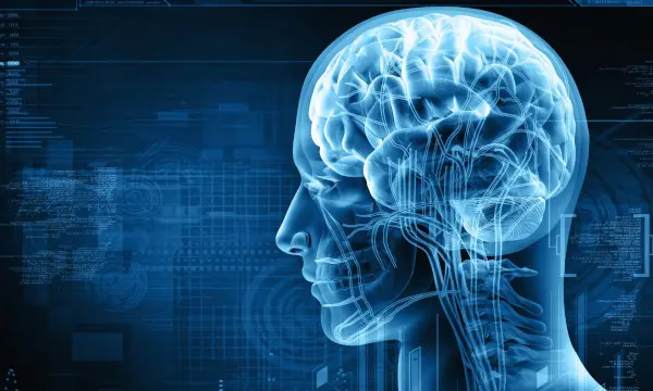 A neurology image of a human head and brain.