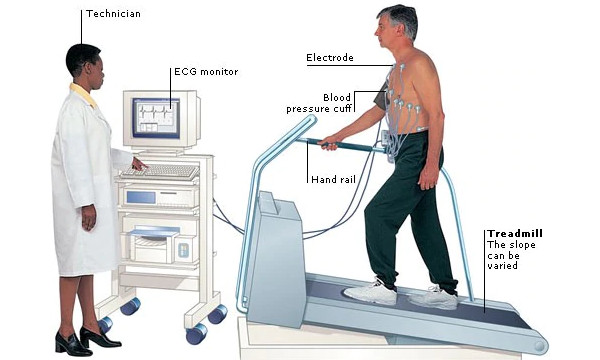 TMT (Treadmill Test)