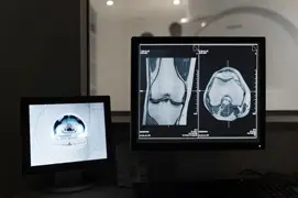 CT Scan