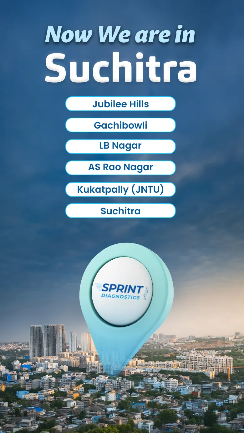  Sprint suchitra Location