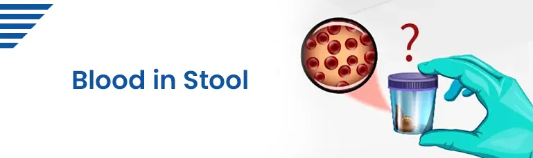 Blood in Stool