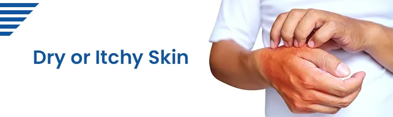 Dry or Itchy Skin
