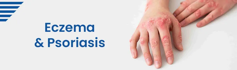 Eczema and Psoriasis