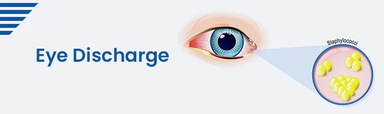 Eye Discharge