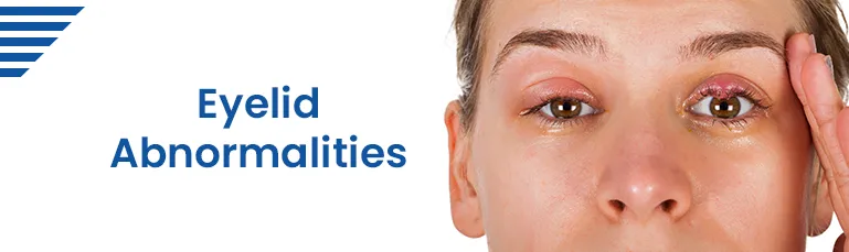 Eyelid Abnormalities