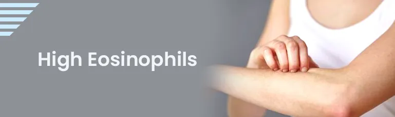 High Eosinophils
