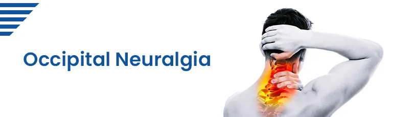 Occipital Neuralgia