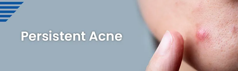 Persistent Acne