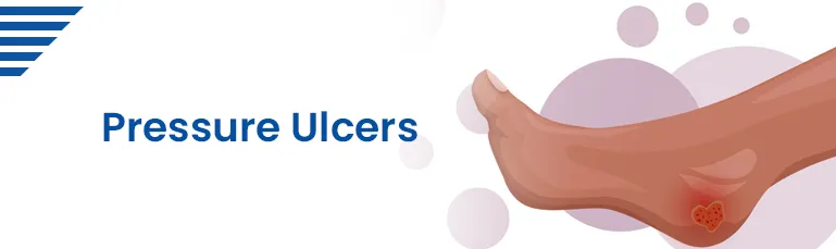 Pressure Ulcers