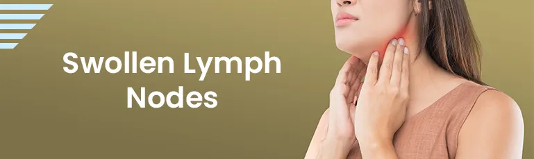 Swollen Lymph Nodes