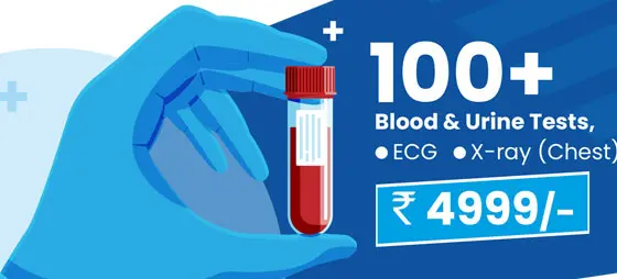 100 lab tests Package